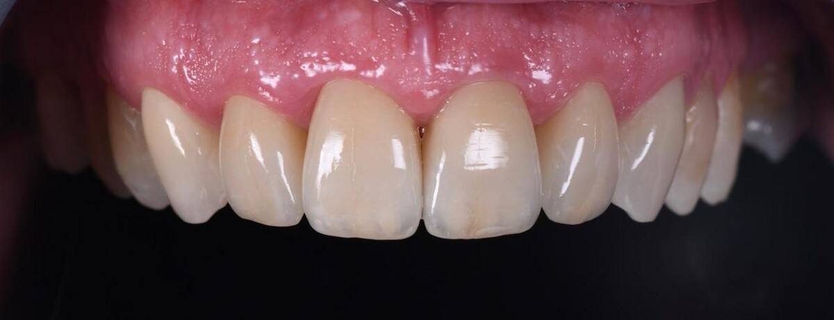 Images City Dentists