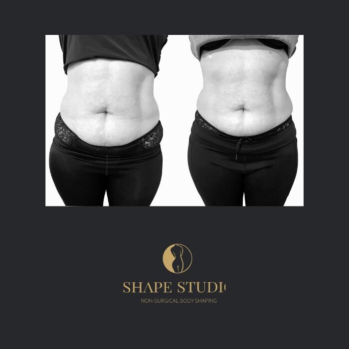 Images Shape Studio