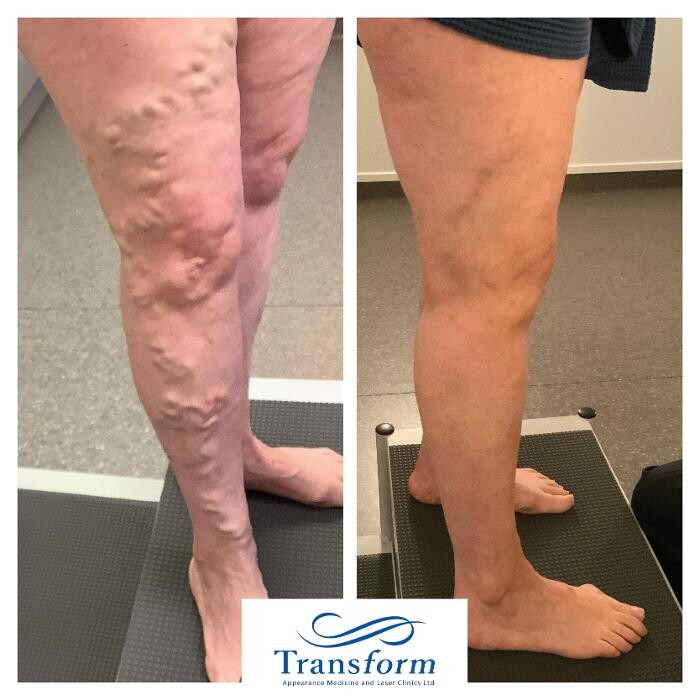 Images Transform Clinic Dunedin