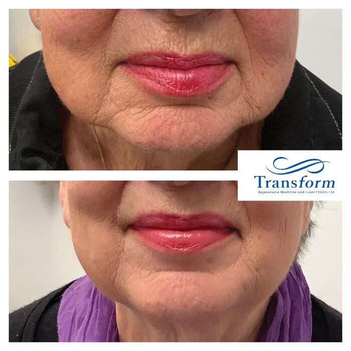 Images Transform Clinic Dunedin