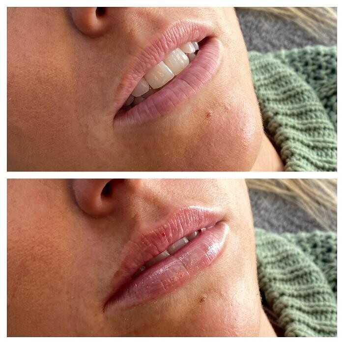 Images Transform Clinic Dunedin