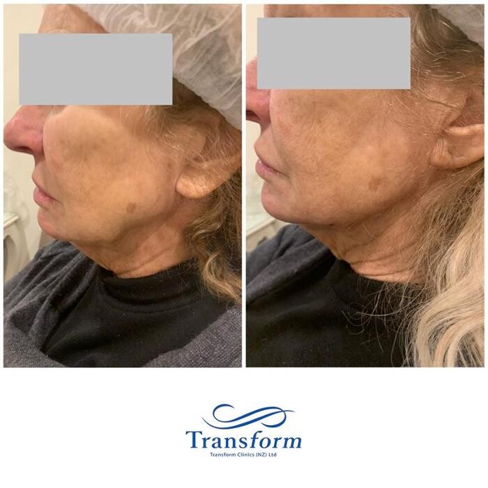 Images Transform Clinic Oamaru