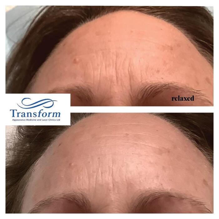 Images Transform Clinic Queenstown