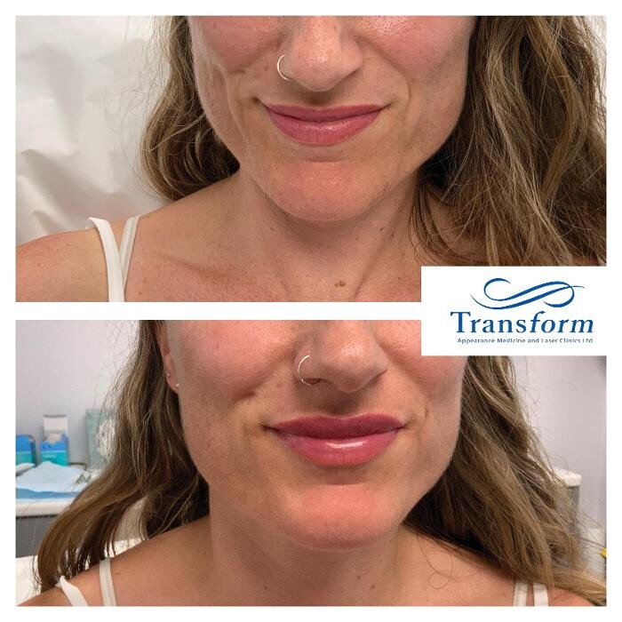 Images Transform Clinic Queenstown