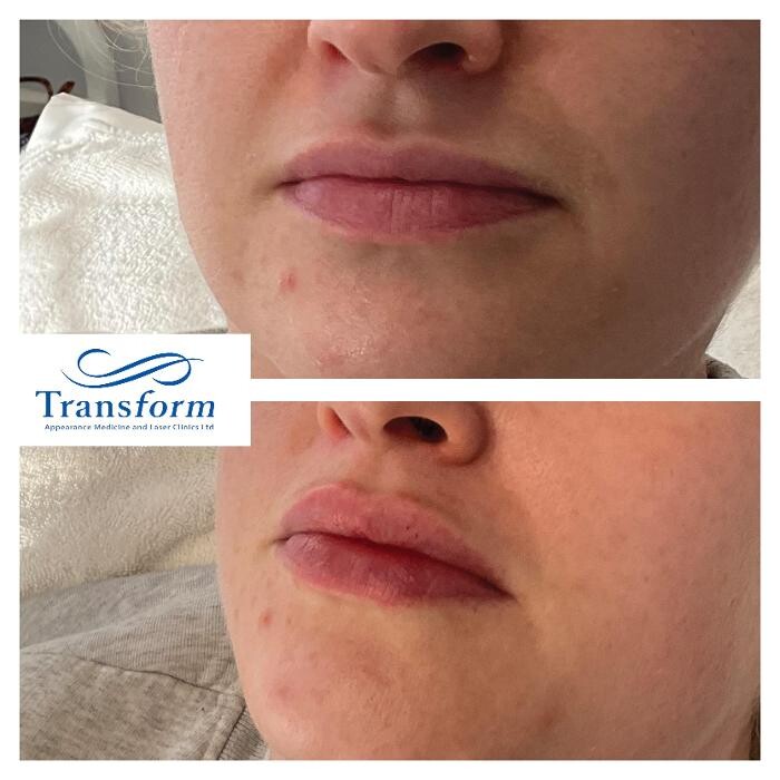 Images Transform Clinic Queenstown