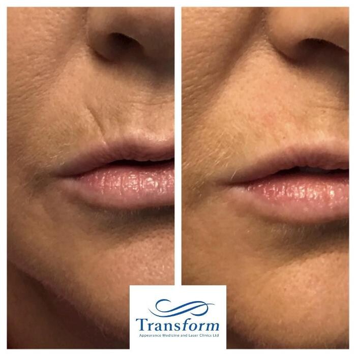 Images Transform Clinic Greymouth