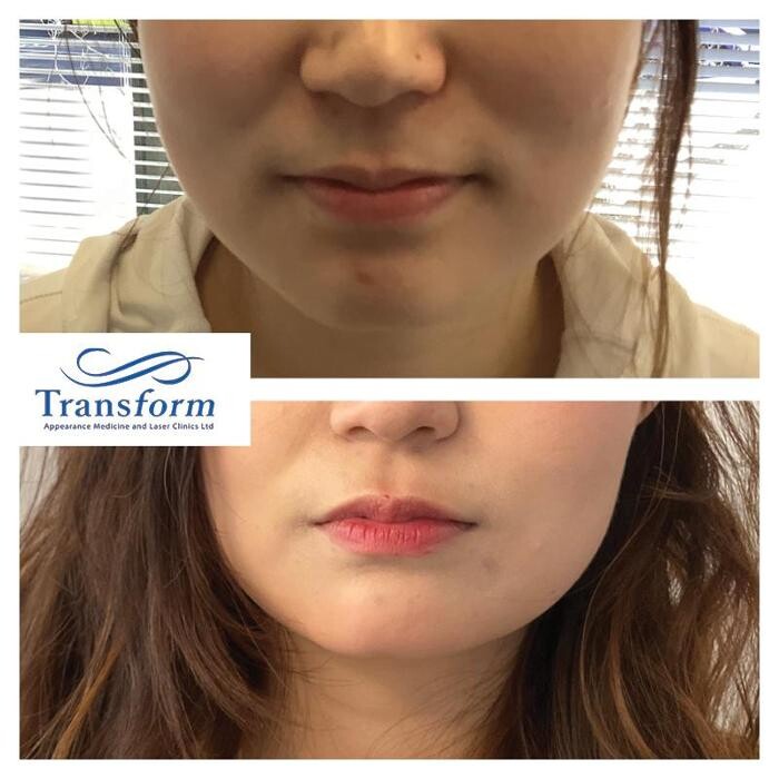 Images Transform Clinic Greymouth