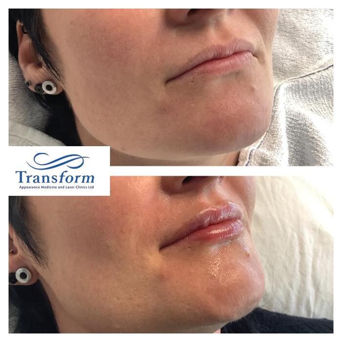 Images Transform Clinic Greymouth