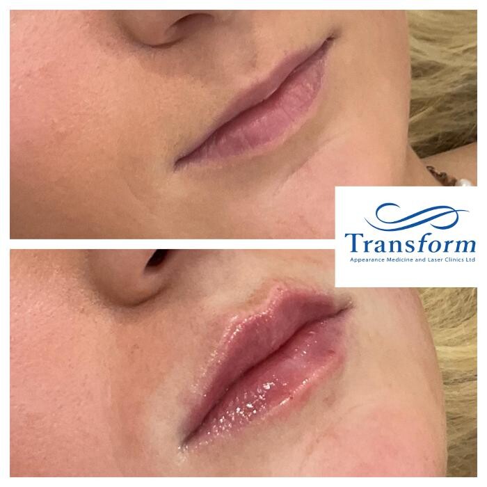 Images Transform Clinic Greymouth