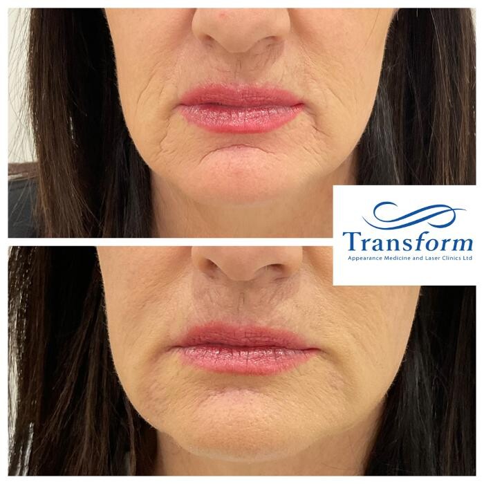 Images Transform Clinic Greymouth