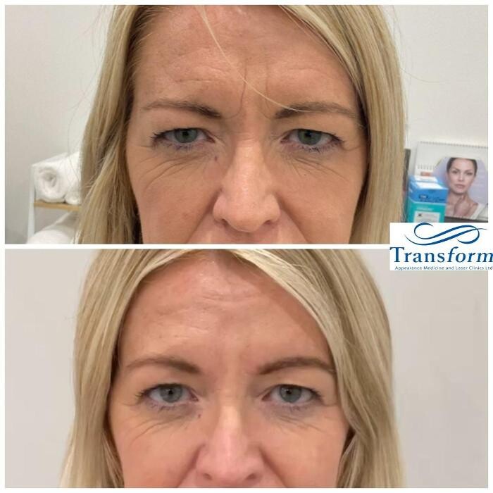 Images Transform Clinic Merivale