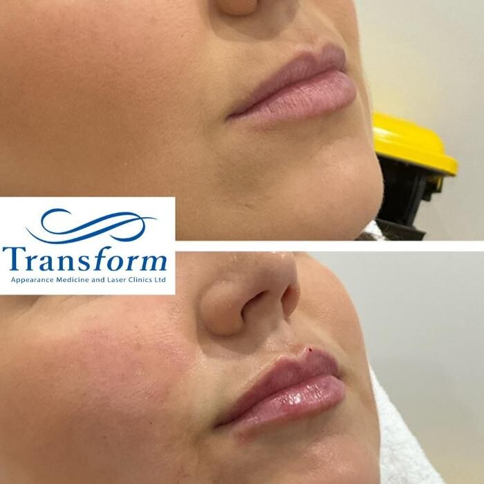 Images Transform Clinic Merivale