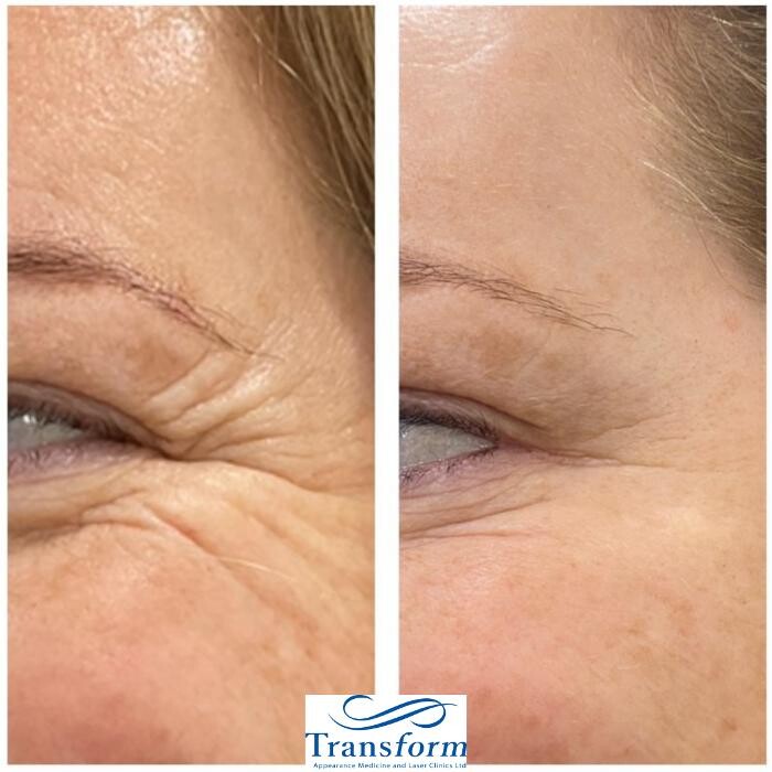 Images Transform Clinic Merivale