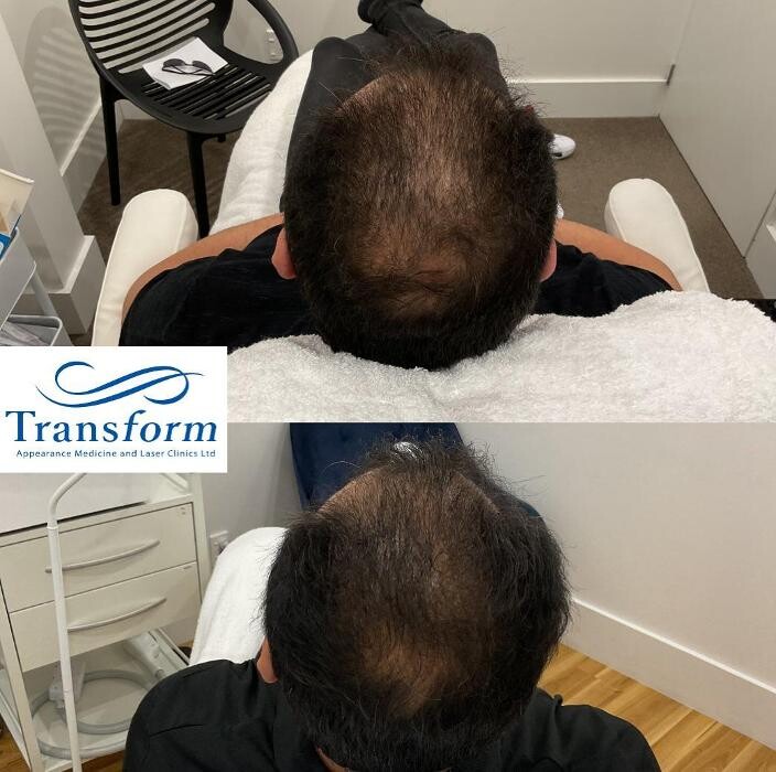 Images Transform Clinic Merivale