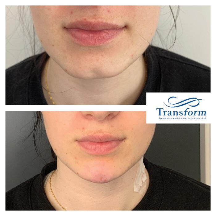 Images Transform Clinic Riccarton