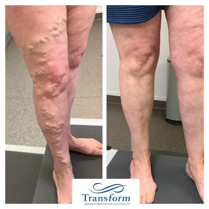 Images Transform Clinic Riccarton