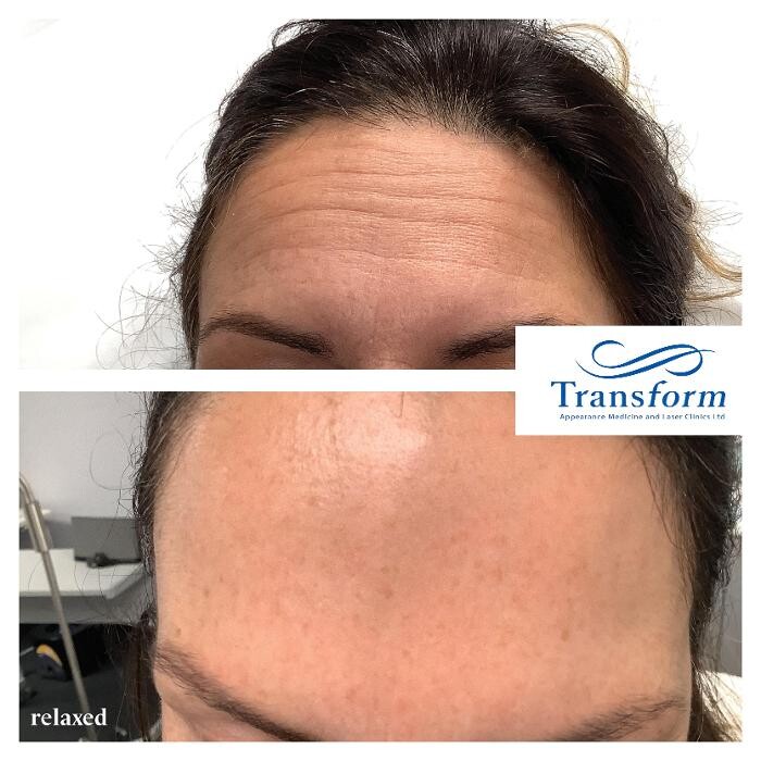 Images Transform Clinic Riccarton