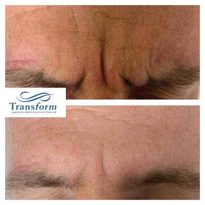 Images Transform Clinic Riccarton