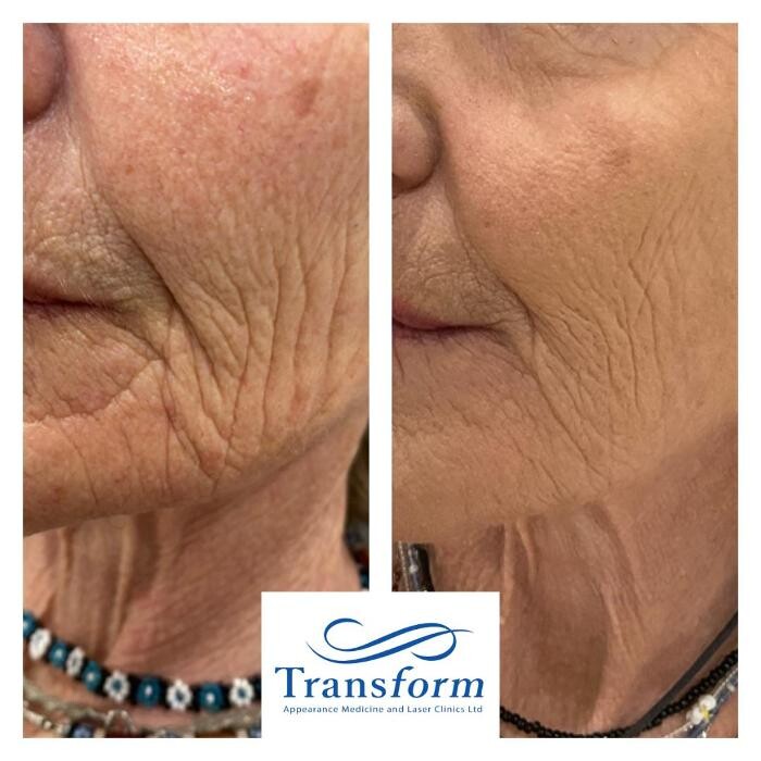 Images Transform Clinic Timaru