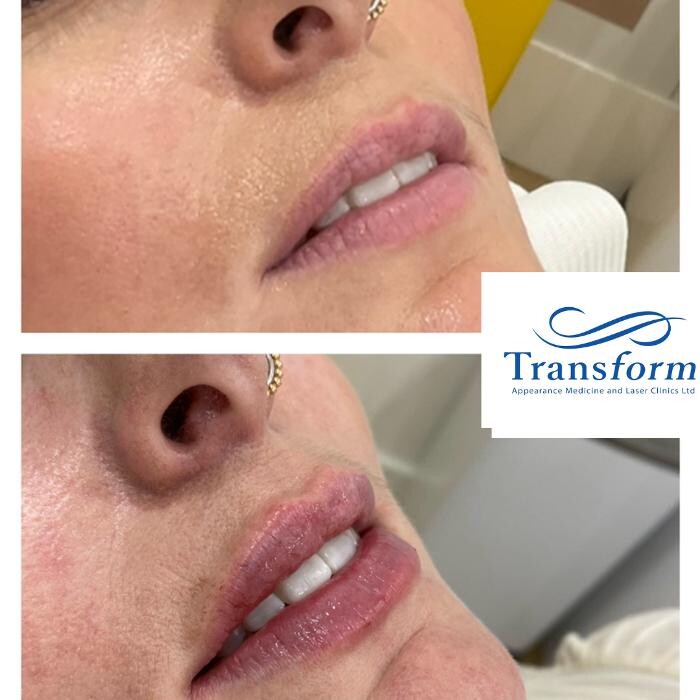 Images Transform Clinic Timaru