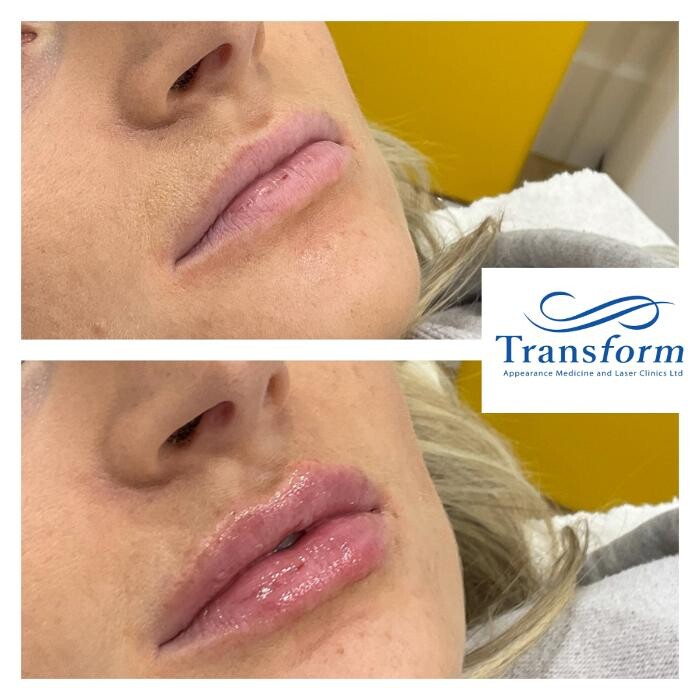 Images Transform Clinic Timaru