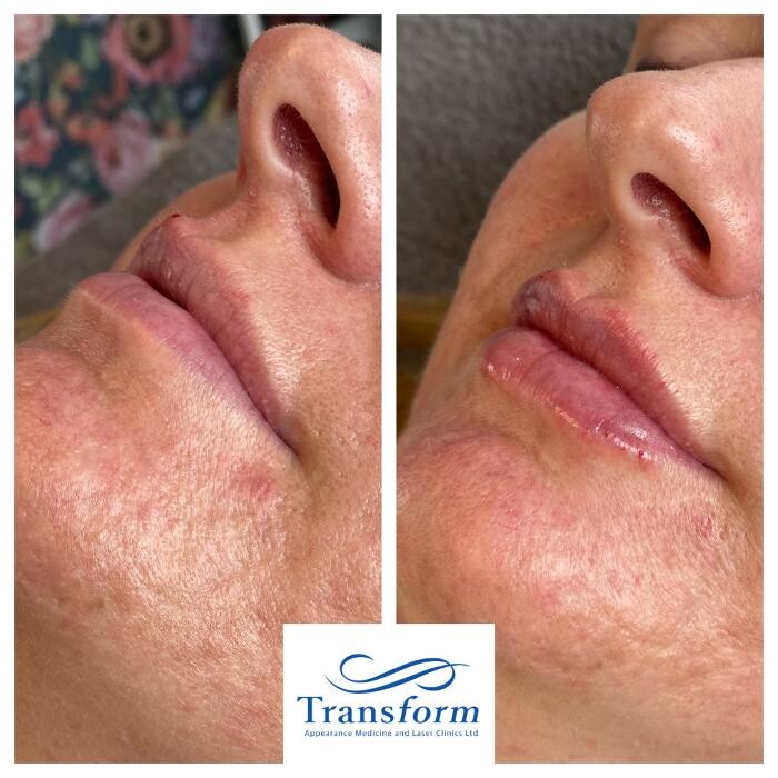 Images Transform Clinic Timaru