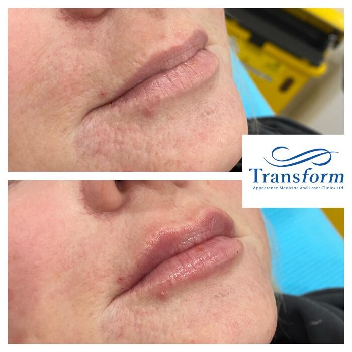 Images Transform Clinic Timaru