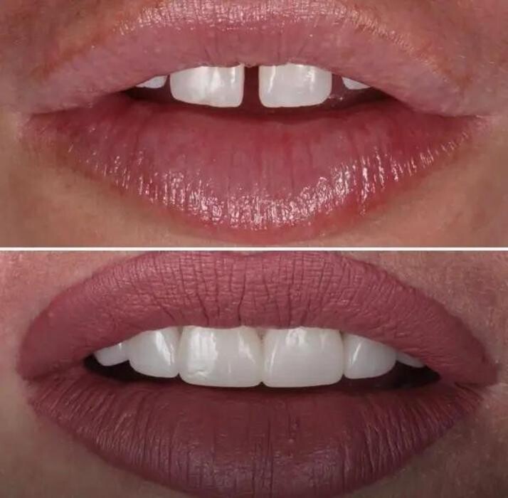 Images Tantalya Dental Clinic