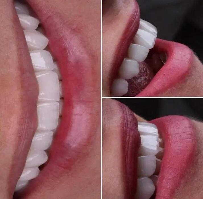 Images Tantalya Dental Clinic