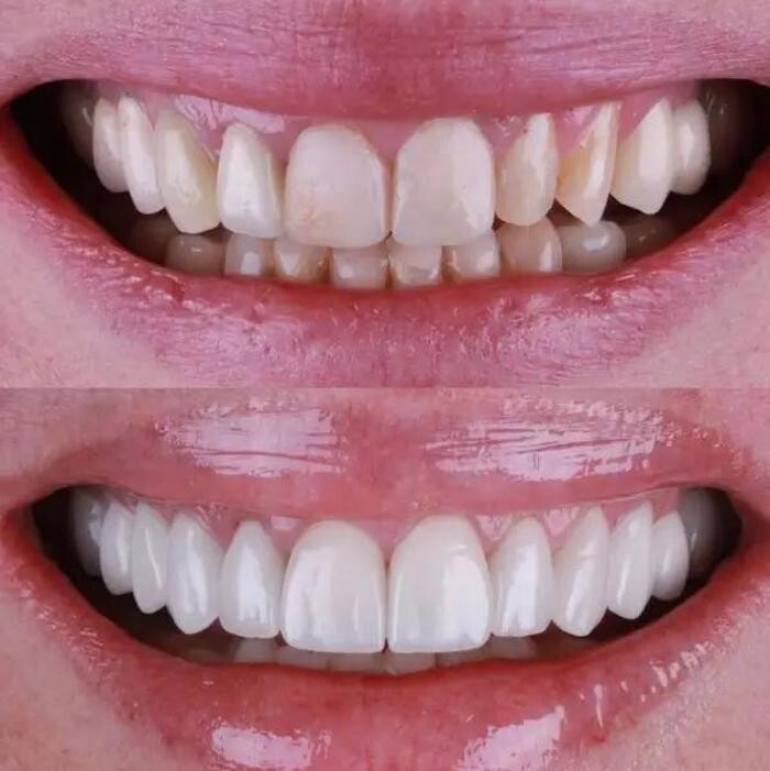 Images Tantalya Dental Clinic