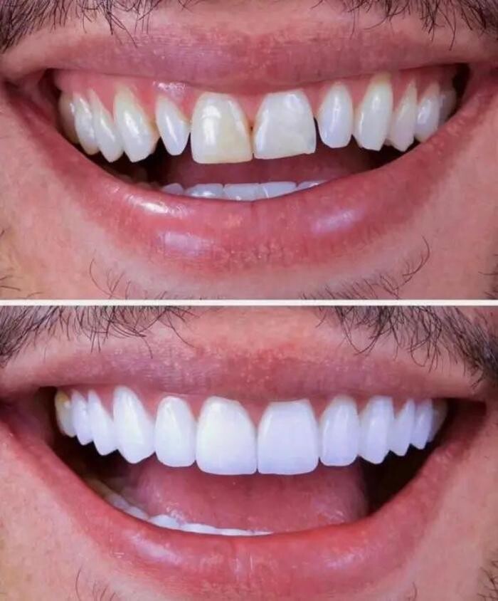 Images Tantalya Dental Clinic