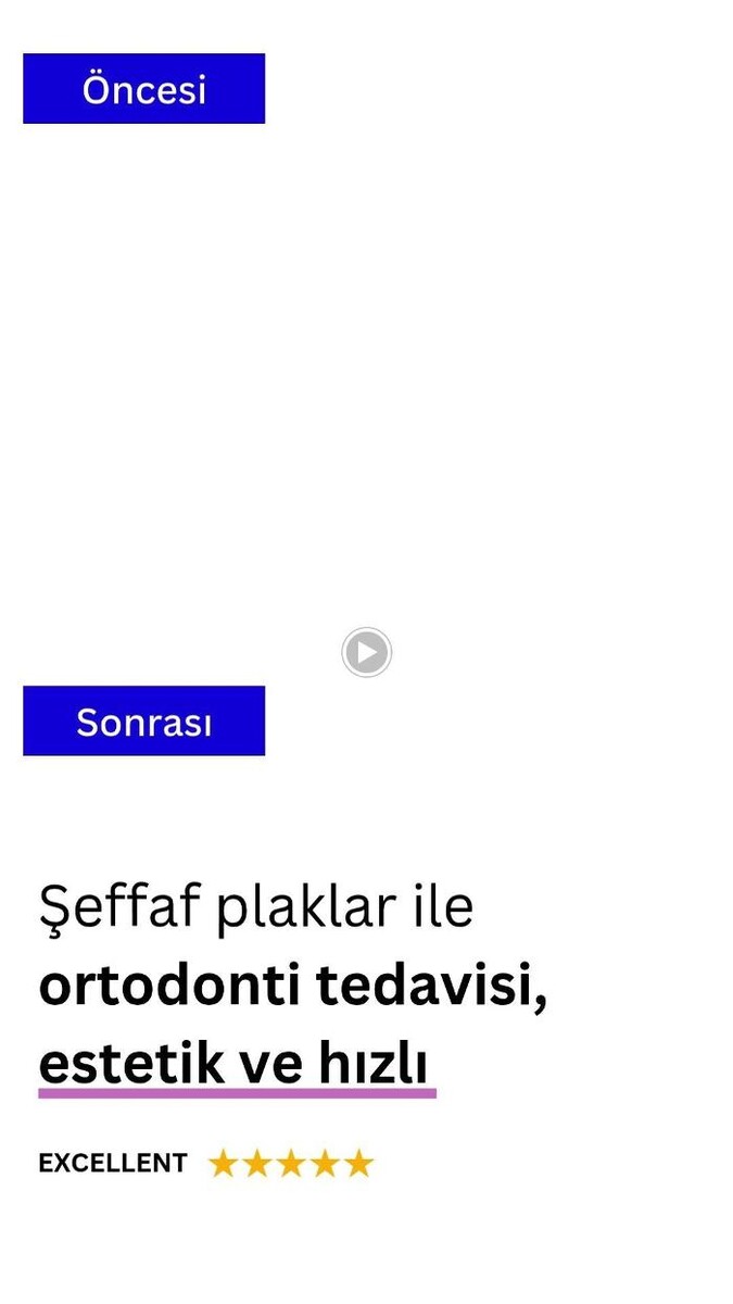 Images Ortodonti Uzmanı Çağrı Şibal - Ortodontik Tedavi I İzmir Şeffaf Plak I invisalign