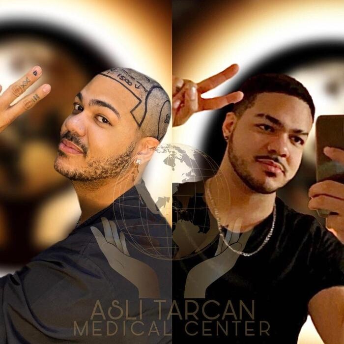 Images Asli Tarcan Clinic