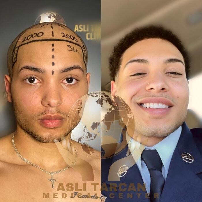 Images Asli Tarcan Clinic