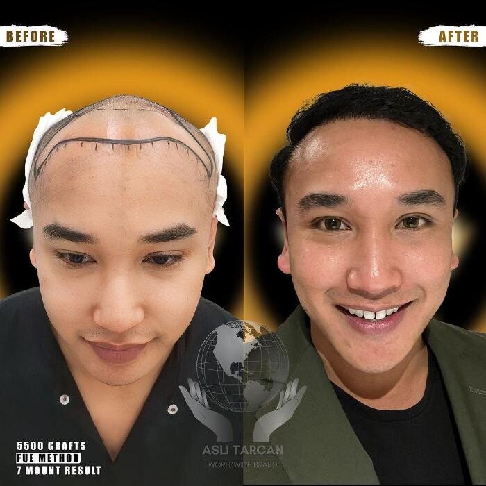 Images Asli Tarcan Clinic