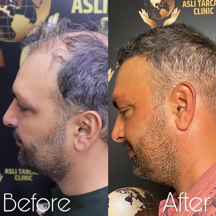 Images Asli Tarcan Clinic