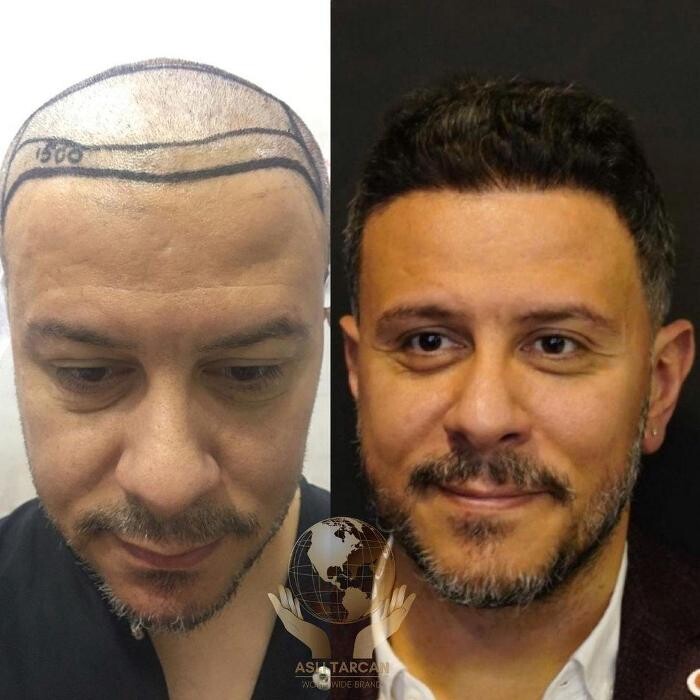 Images Asli Tarcan Clinic