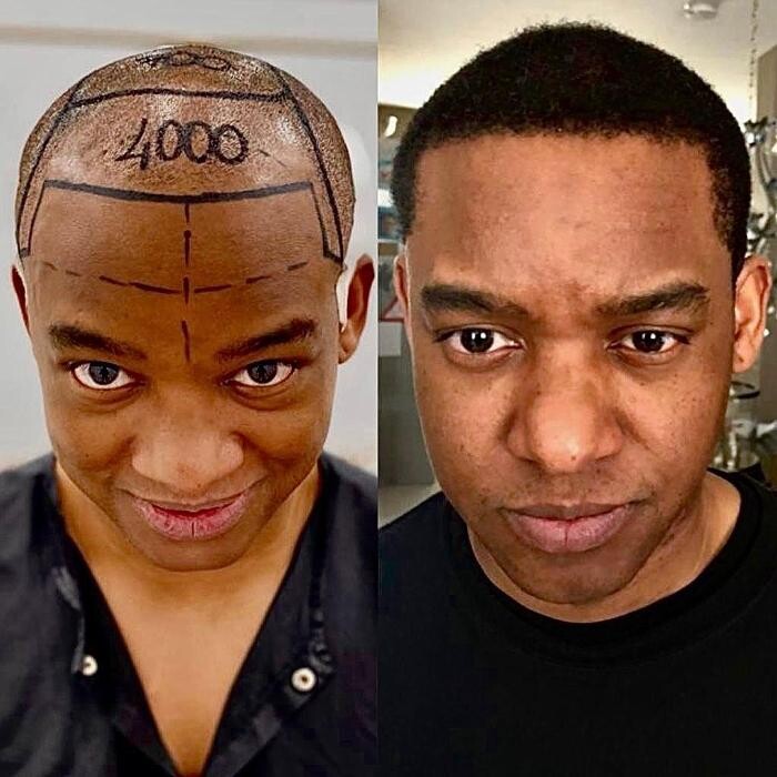 Images Asli Tarcan Clinic