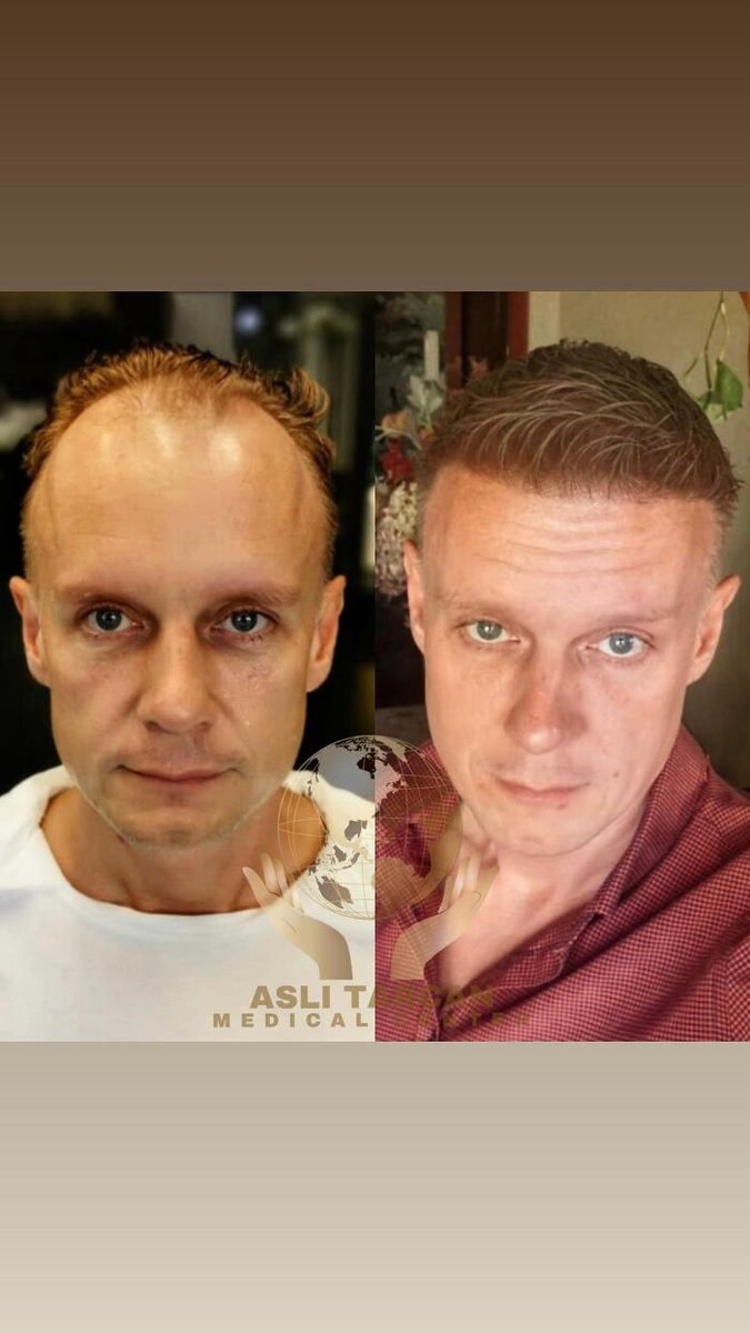 Images Asli Tarcan Clinic