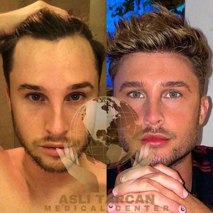 Images Asli Tarcan Clinic