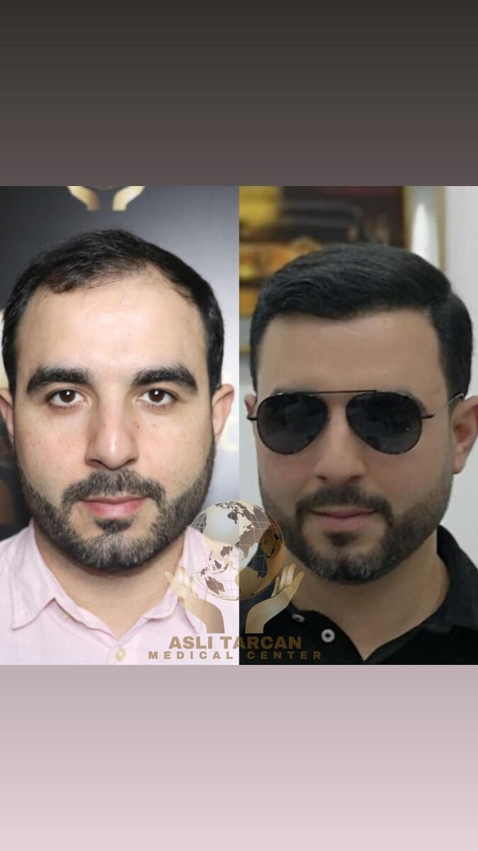 Images Asli Tarcan Clinic