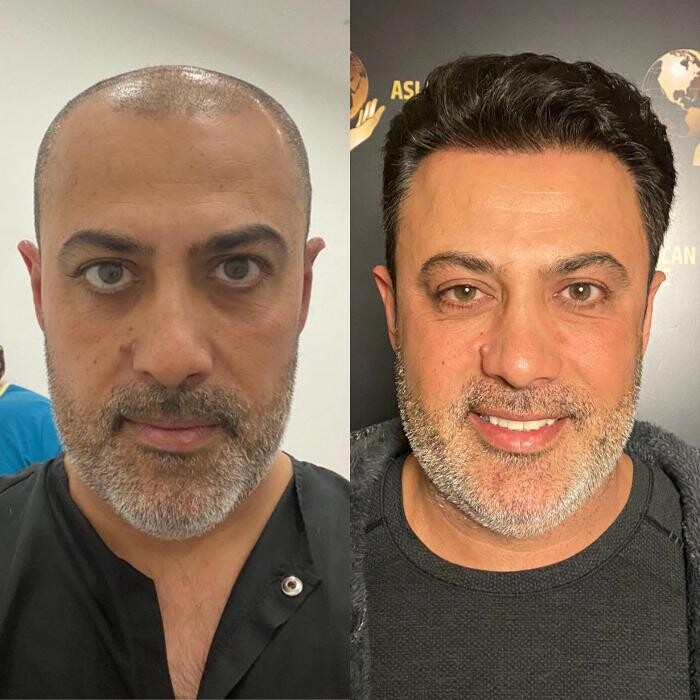 Images Asli Tarcan Clinic