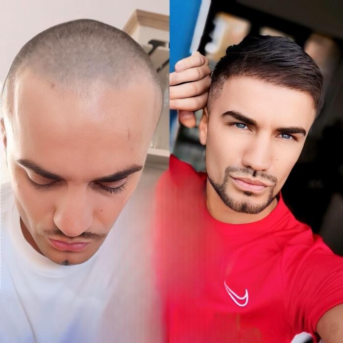 Images Asli Tarcan Clinic