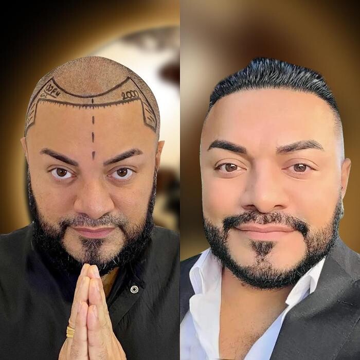 Images Asli Tarcan Clinic