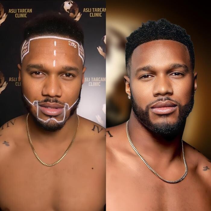 Images Asli Tarcan Clinic