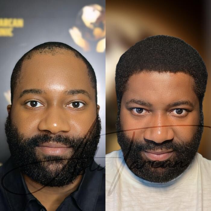 Images Asli Tarcan Clinic