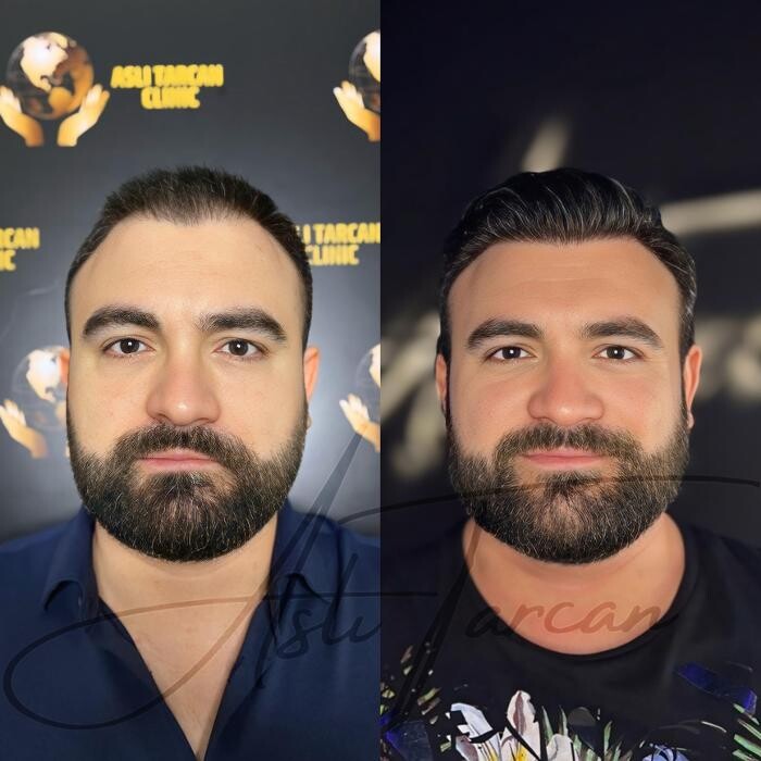 Images Asli Tarcan Clinic