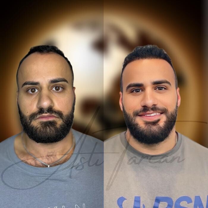 Images Asli Tarcan Clinic