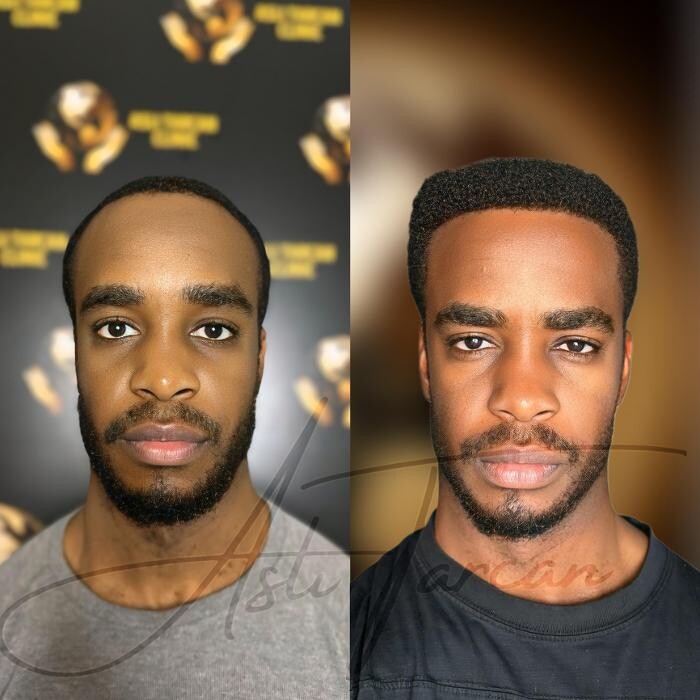 Images Asli Tarcan Clinic