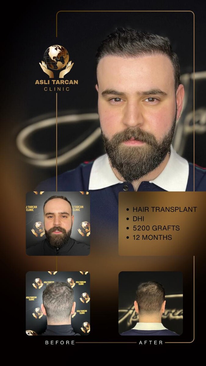 Images Asli Tarcan Clinic